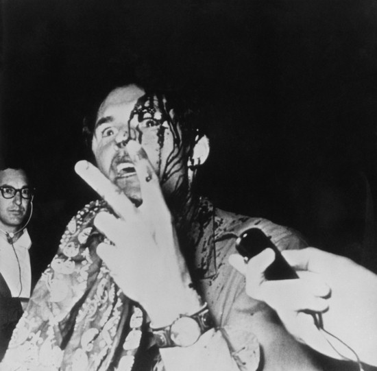 A photgrapher bleeding from a head wound given to him by police during the riots in Grant Park outside the 1968 Democratic National Convention gives the peace sign as he is interviewed, Chicago, Illinois, August 28, 1968. The demonstration, held across the street from Democratic Headquarters Hotel, erupted into violence after Chicago police tried to break up the anti-Vietnam War protest. (Photo by Agence France Presse/Getty Images)