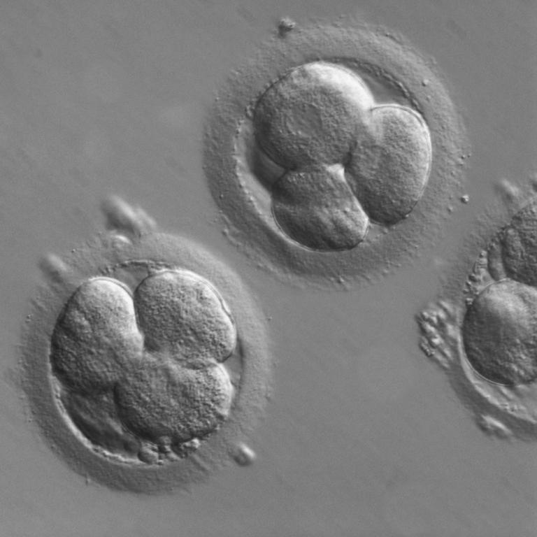 plasdic_human-embryo_axio-observer_11.jpg